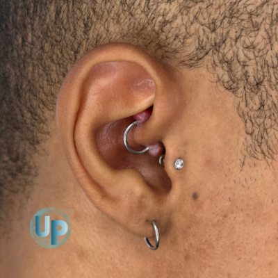 O que é granuloma Universo do Piercing